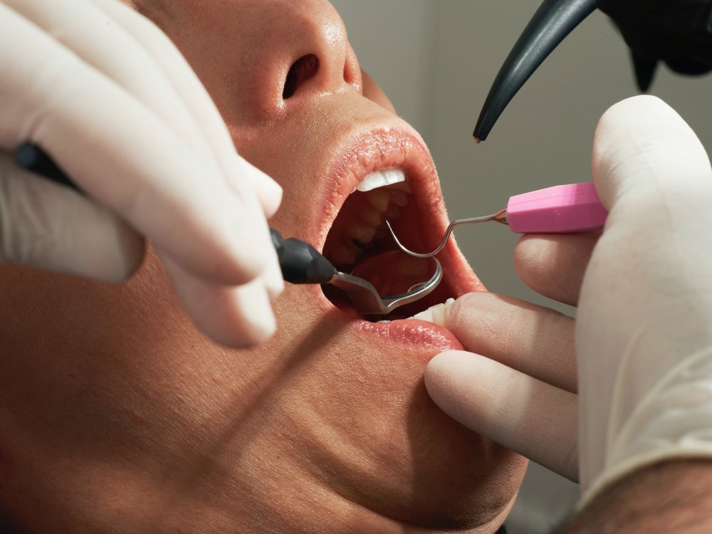 Tandläkare i Sollentuna lagar dina tänder